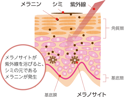 シミの原因